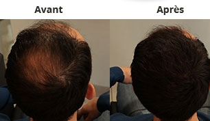 Gamme Hair 30 Avant/Après homme- Salon Couleur Chocolat à Annemasse en Haute-Savoie (74)